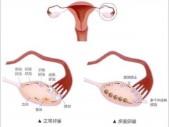 「全面了解」北京代妈25万起-上海同恩助孕生殖中心